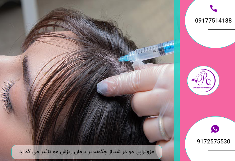 مزوتراپی مو در شیراز چگونه بر درمان ریزش مو تاثیر می گذارد