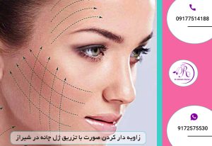 زاویه دار کردن صورت با تزریق ژل چانه در شیراز