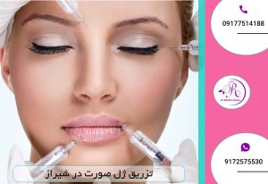 تزریق ژل صورت در شیراز