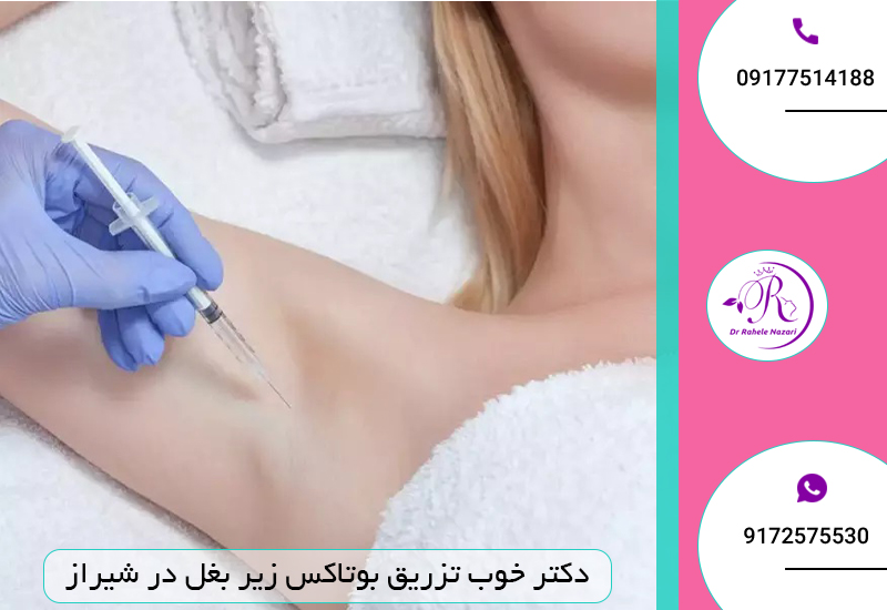 دکتر خوب تزریق بوتاکس زیر بغل در شیراز