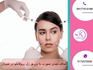 صاف شدن صورت با تزریق ژل پروفایلو در شیراز