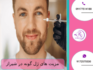 مزیت های ژل گونه در شیراز