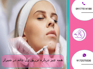 همه چیز درباره تزریق ژل چانه در شیراز