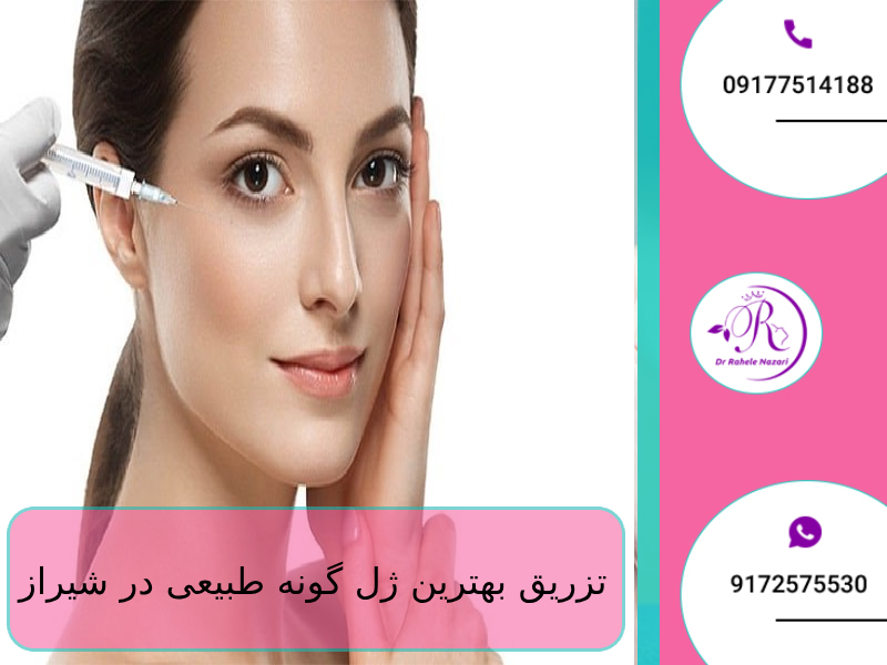 تزریق بهترین ژل گونه طبیعی در شیراز