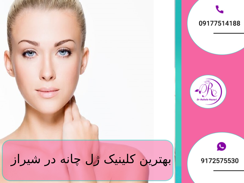 بهترین کلینیک ژل چانه در شیراز