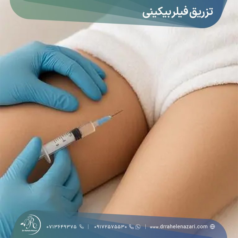 تزریق فیلر بیکینی شیراز