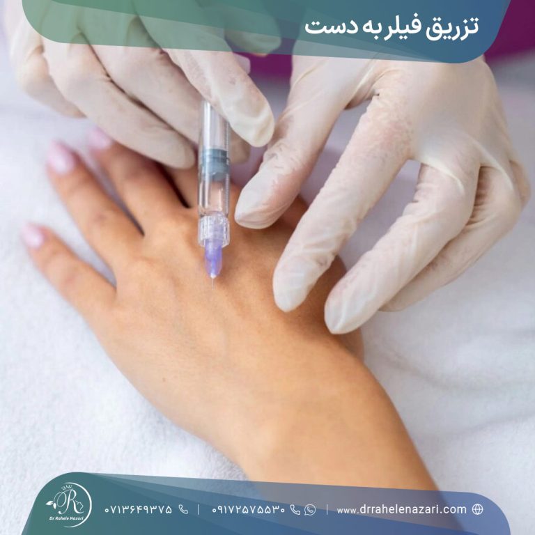 تزریق فیلر دست شیراز