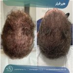 هیر فیلر شیراز