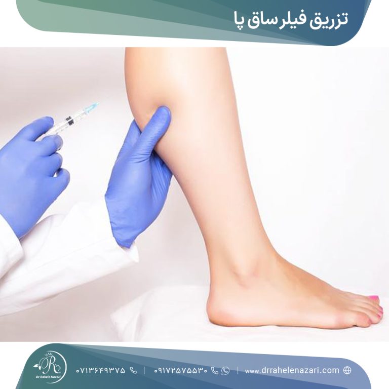 تزریق فیلر ساق پا شیراز تزریق فیلر ساق پا شیراز