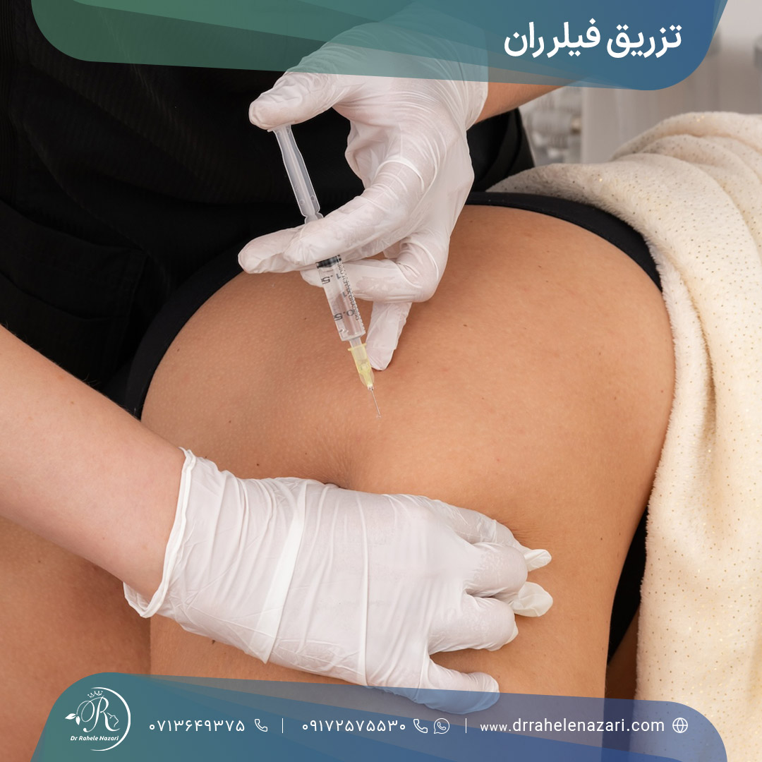 تزریق فیلر برای حجیم و فرم دهی کردن ران