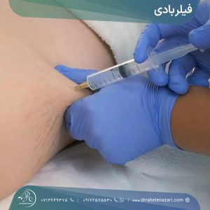 فیلر بادی در شیراز
