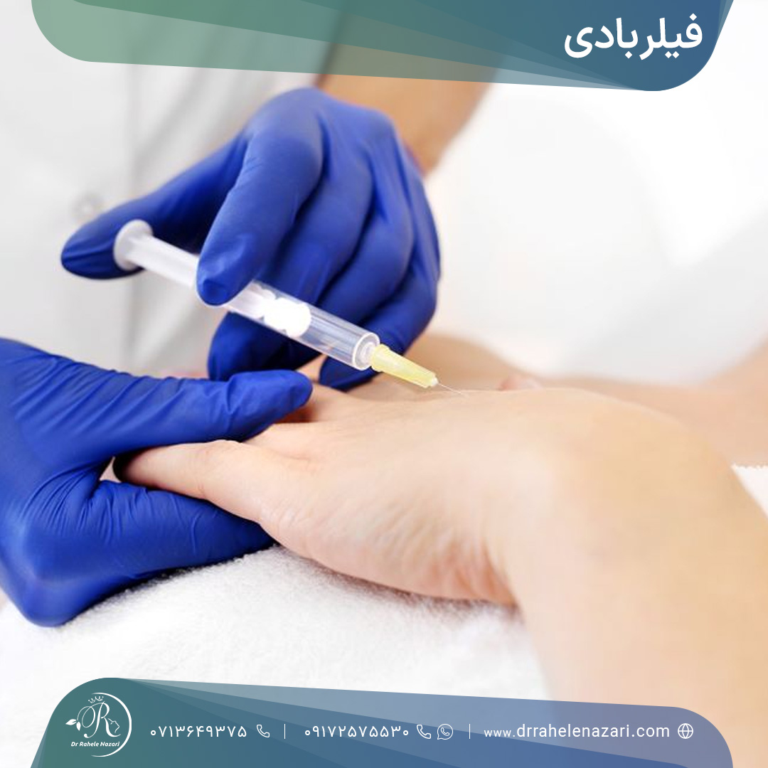تزریق فیلر دست برای انجام فیلر بادی
